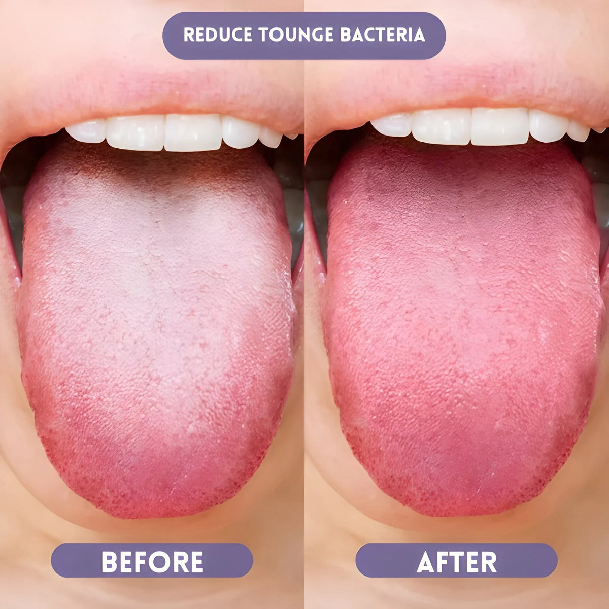 🏆Flash Sale⚡ 50K+ SOLD!🦷 Probiotic Oral Spray🍋