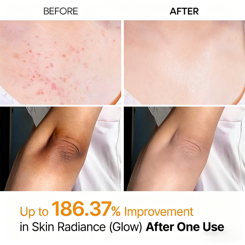 Tkhotpick Peel Shot - Kojic + Turmeric Body Peel Spray